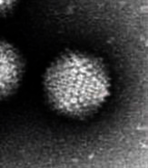 Hep A